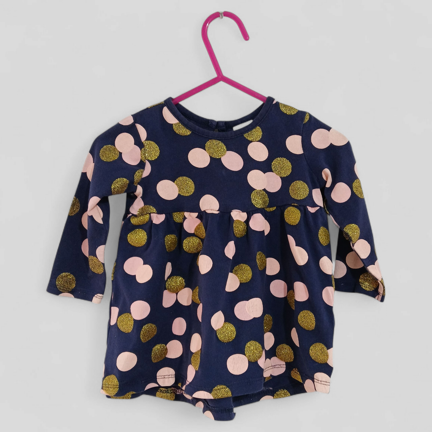 (00) Target | Confetti Dress